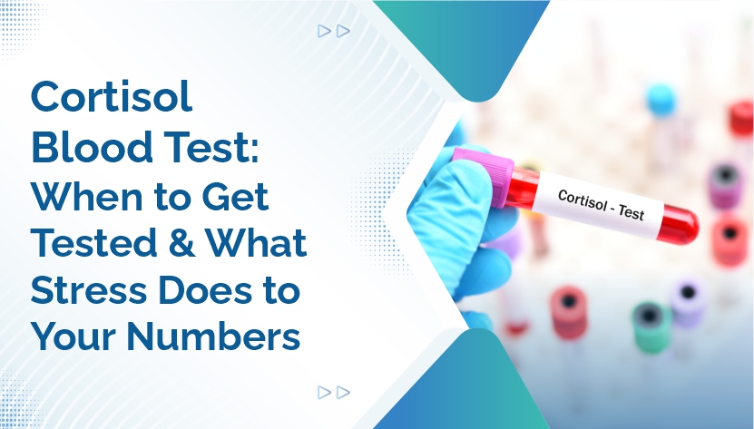 Cortisol Blood Test: When to Get Tested and What Stress Does to Your Numbers